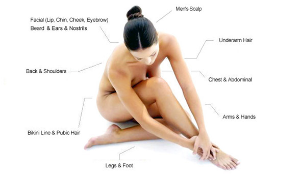 Places you can get laser hair removal