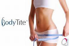 BodyTite